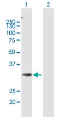 Western Blot: AWAT1 Antibody [H00158833-B01P]