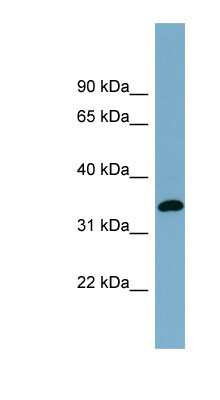 Western Blot: AWAT1 Antibody [NBP1-59865]