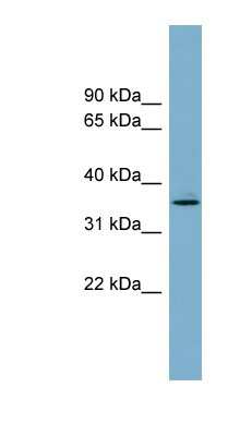 Western Blot: AWAT1 Antibody [NBP1-59866]