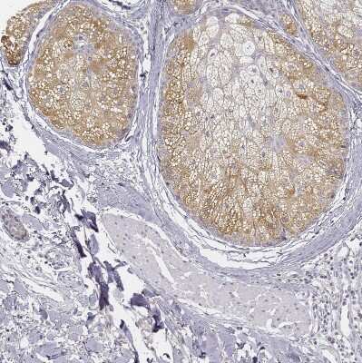 Immunohistochemistry-Paraffin: AWAT2 Antibody [NBP2-38003]