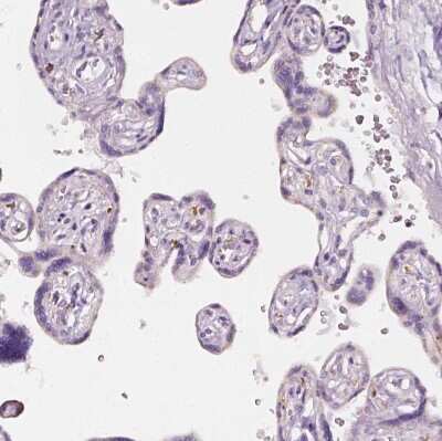 Immunohistochemistry-Paraffin: AWAT2 Antibody [NBP2-38003]