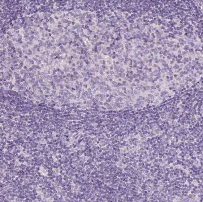 Immunohistochemistry-Paraffin: AWAT2 Antibody [NBP2-38003]