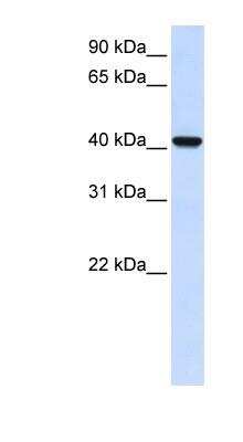 Western Blot: AWAT2 Antibody [NBP1-91574]