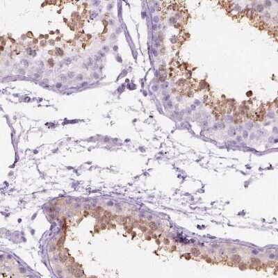 Immunohistochemistry-Paraffin: AXDND1 Antibody [NBP2-49645]