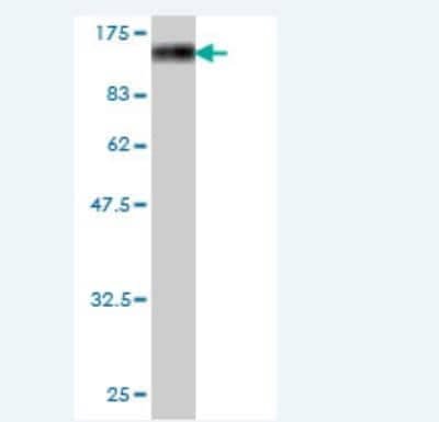 Western Blot: AXUD1 Antibody (5E8) [H00064651-M01]