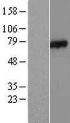 Western Blot: AXUD1 Overexpression Lysate [NBL1-07870]