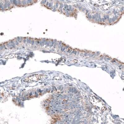 Immunohistochemistry-Paraffin: AZ1 Antibody [NBP1-90053]