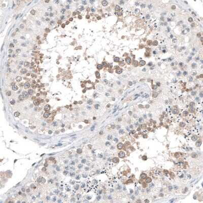 Immunohistochemistry-Paraffin: AZ1 Antibody [NBP1-90053]
