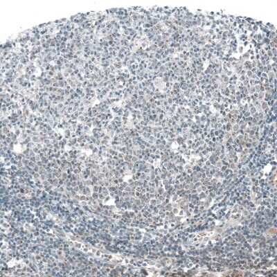 Immunohistochemistry-Paraffin: AZ1 Antibody [NBP1-90053]