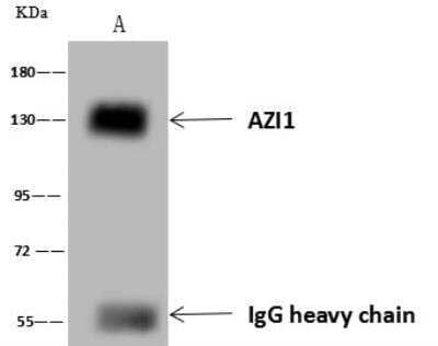 Immunoprecipitation: AZ1 Antibody [NBP3-12647]