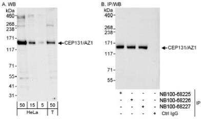 Western Blot: AZ1 Antibody [NB100-68225]