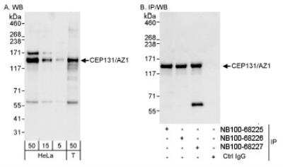 Western Blot: AZ1 Antibody [NB100-68227]