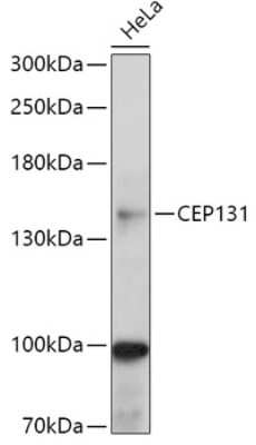 Western Blot: AZ1 AntibodyAzide and BSA Free [NBP2-92366]