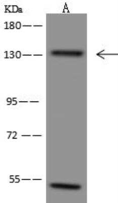 Western Blot: AZ1 Antibody [NBP3-12647]