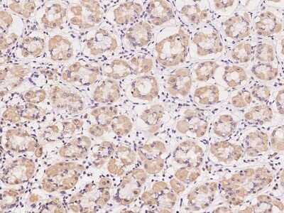 Immunohistochemistry-Paraffin: AZI2 Antibody [NBP2-97191]