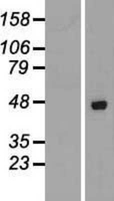 Western Blot: AZI2 Overexpression Lysate [NBP2-06437]