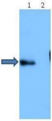 Western Blot: Abeta 40 Antibody [NBP1-44047]