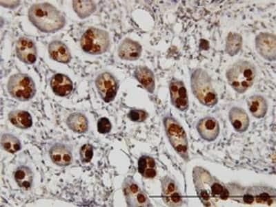 Immunohistochemistry-Paraffin: Abhd5 Antibody (1F3) [H00051099-M01]