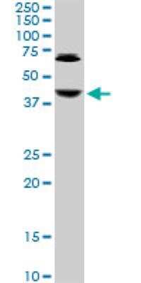 Western Blot: Abhd5 Antibody (1F3) [H00051099-M01]