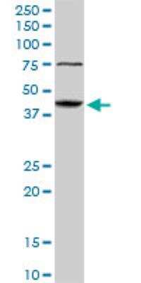 Western Blot: Abhd5 Antibody (1F3) [H00051099-M01]
