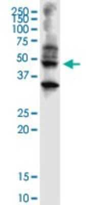 Western Blot: Abhd5 Antibody (1F3) [H00051099-M01]