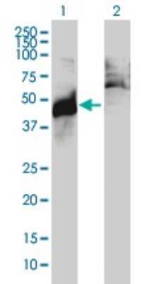 Western Blot: Abhd5 Antibody (1F3) [H00051099-M01]