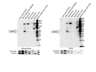 Western Blot: Abhd5 Antibody (1F3) [H00051099-M01]