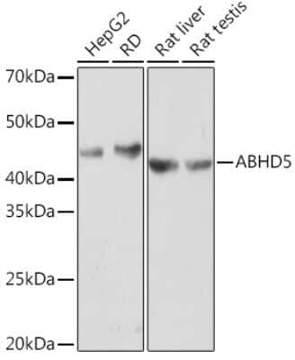 Western Blot: Abhd5 Antibody (2K8W9) [NBP3-16675]