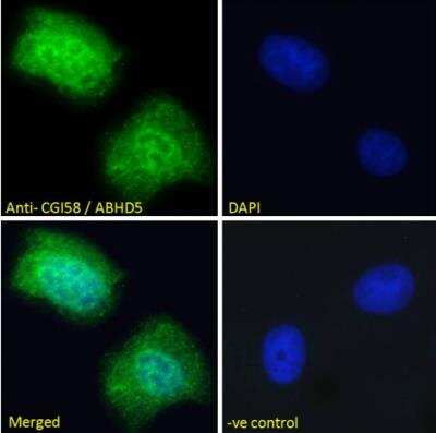 Immunocytochemistry/ Immunofluorescence: Abhd5 Antibody [NB100-57850]