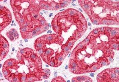 Immunohistochemistry-Paraffin: Abhd5 Antibody [NB100-57850]