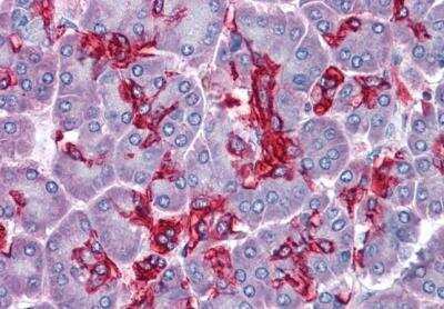 Immunohistochemistry-Paraffin: Abhd5 Antibody [NB100-57850]
