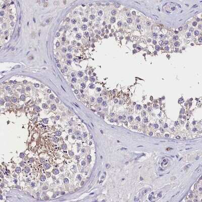 Immunohistochemistry-Paraffin: Abhd5 Antibody [NBP1-84507]
