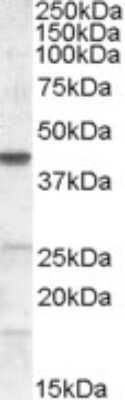 Western Blot: Abhd5 Antibody [NB100-57850]