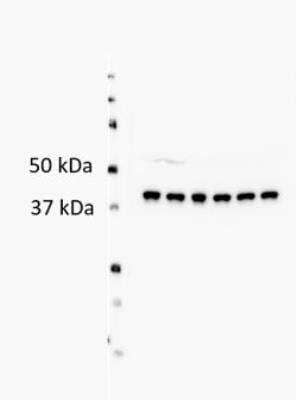 Western Blot: Abhd5 Antibody [NB100-57850]