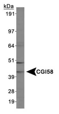 Western Blot: Abhd5 AntibodyBSA Free [NB110-41576]