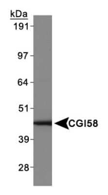 Western Blot: Abhd5 AntibodyBSA Free [NB110-41576]