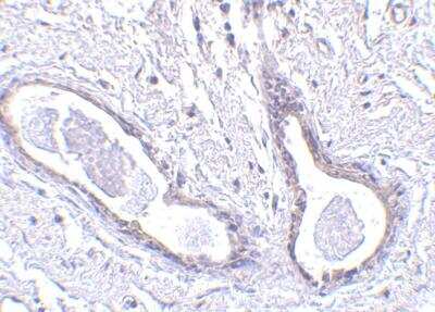 Immunohistochemistry-Paraffin: Abraxas Antibody - BSA Free [NBP1-76827]