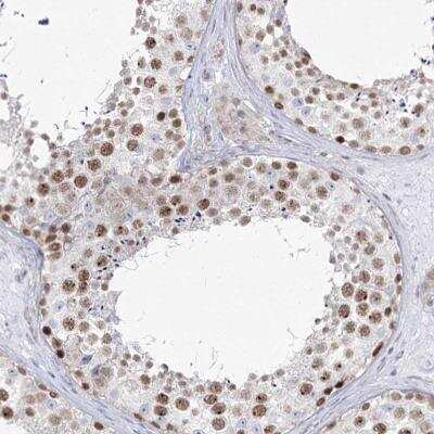 Immunohistochemistry-Paraffin: Abraxas Antibody [NBP2-38356]