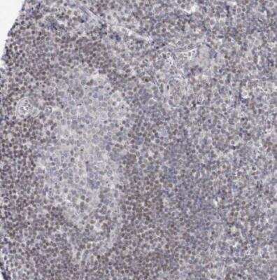 Immunohistochemistry-Paraffin: Abraxas Antibody [NBP2-38356]