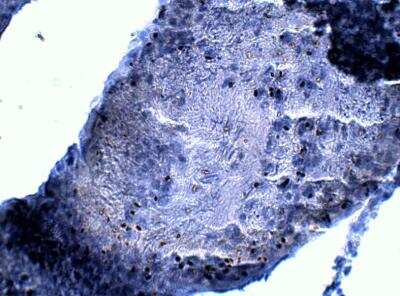 Immunohistochemistry-Paraffin: Abraxas Antibody [NBP3-12376]