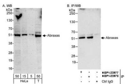 Western Blot: Abraxas Antibody [NBP1-22977]