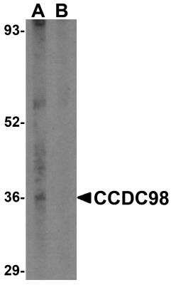 Western Blot: Abraxas AntibodyBSA Free [NBP1-76827]