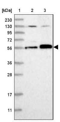 Western Blot: Abraxas Antibody [NBP2-38356]