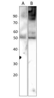 Western Blot: Abraxas Antibody [NBP3-12376]