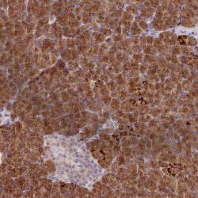 Immunohistochemistry: Absent in melanoma 1 Antibody [NBP2-38171]