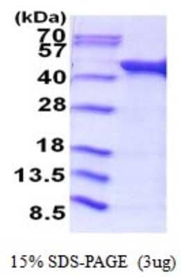 SDS-PAGE: Recombinant E. coli Acetate kinase His Protein [NBP2-51855]