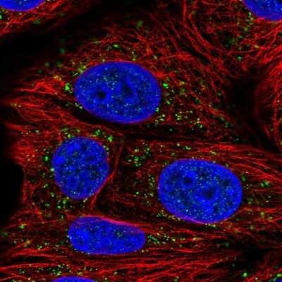 Immunocytochemistry/ Immunofluorescence: Acetoacetyl CoA synthetase Antibody [NBP2-38861]