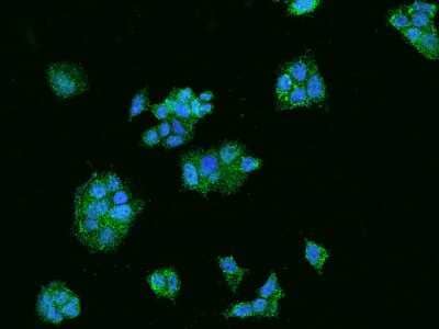 Immunocytochemistry/ Immunofluorescence: Acetoacetyl CoA synthetase Antibody [NBP2-97174]