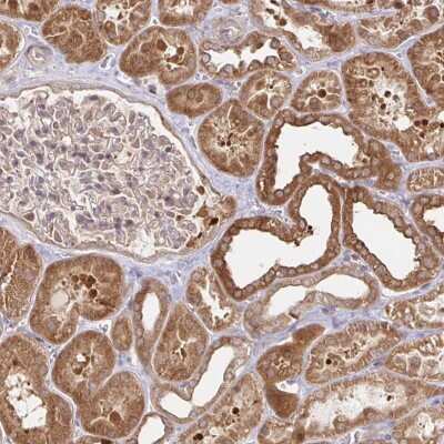 Immunohistochemistry: Acetoacetyl CoA synthetase Antibody [NBP2-38861]