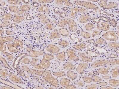 Immunohistochemistry-Paraffin: Acetoacetyl CoA synthetase Antibody [NBP2-97174]